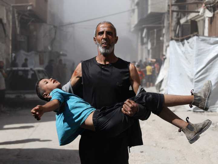 Foreign doctors say Israel systematically targeting Gaza’s children: Report