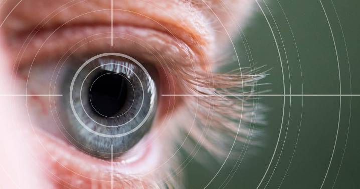 OCT can monitor neurodegeneration in multiple sclerosis