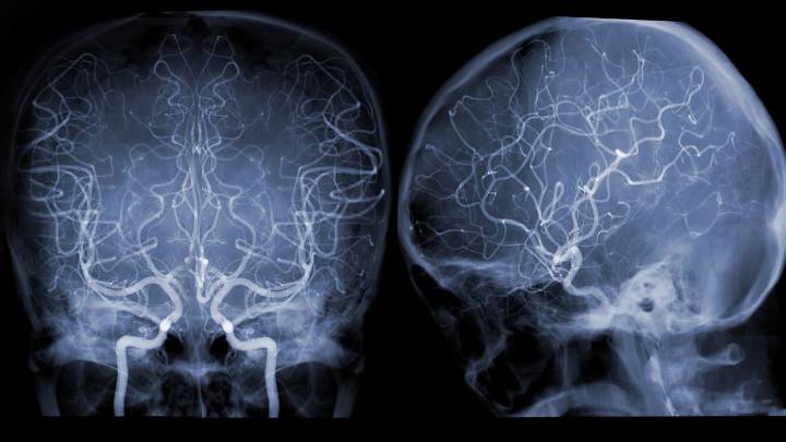 Histórico: medicamento experimental logra curar a un niño con un tumor cerebral terminal