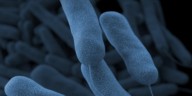 Legionnaires’ disease cases rise to 34 in central Iowa, officials say
