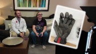'I am my gamertag': Fingers nearly amputated, saved by unique procedure