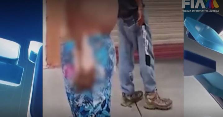 Víctimas de la explosión en Iztapalapa podrían necesitar tratamiento por hasta 15 años: cirujano