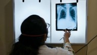 El Gobierno de este país prometió eliminar la tuberculosis para finales de 2025. No está yendo bien