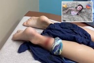 Shark bites 8-year-old girl in grisly Texas beach attack: 'It was just so much blood'