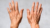 Dile adiós a la estética: el aceite esencial que hará que tus manos rejuvenezcan y se aclaren