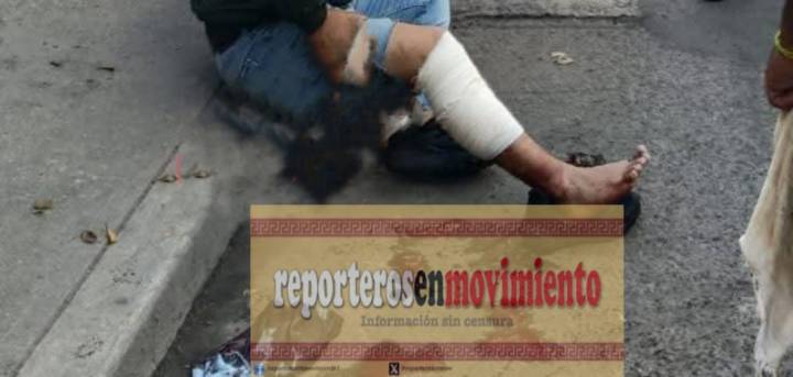 OTRA VÍCTIMA DE LOS MOTO-RATONES, LE DISPARARON EN EL PIE Y LO DESPOJARON DE SU MOTOCICLETA EN CHALCO