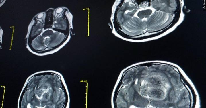 Gunman who blamed NFL for hiding brain injury dangers had CTE, medical examiner confirms