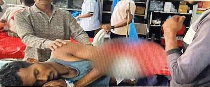Odisha: Rare feat as doctors in Koraput MCH remove arrow piercing youth's stomach, save life