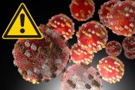 Measles Cases Climb In New Jersey With New Exposure Warnings