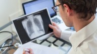 Riverside teen contracts tuberculosis, raising exposure risk concerns