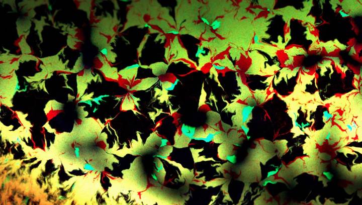 Infectious Mouth Bacteria Lurking In Artery Plaques Could Be Behind Some Heart Attacks
