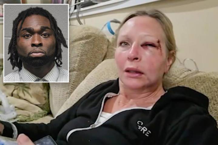 Chicago mom, Kathleen Miles, knocked out by career criminal William Livingston in Downtown attack