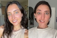 Woman's Tongue Goes Numb, Then Half of Her Face Stopped Working (Exclusive)