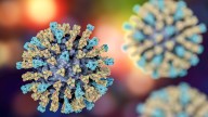 Orange County toddler infected with measles