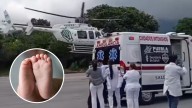 Bebé Sufre Lesión en la Cabeza con una Posible Bala en Puebla; Necesitó Traslado en Helicóptero