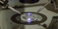 Demand for IVF brings more options to Charlotte