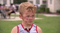 8-year-old boy recovering after hit and run at Fort Worth apartment complex