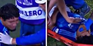 Millonarios confirma lesión de Juan Carlos Pereira en su partido 200: sufrió una ruptura del tendón de Aquiles
