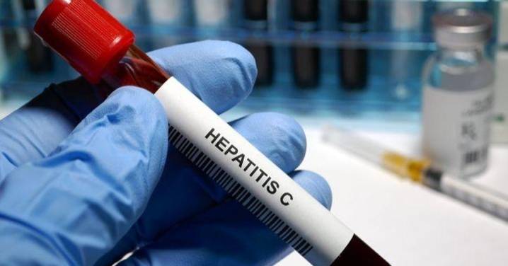 La infección activa de la hepatitis C en personas con VIH cae por debajo del 1%