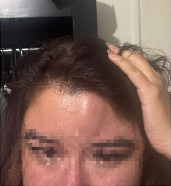 Mujer denuncia haber sido agredida brutalmente por su expareja