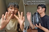 I was born without thumbs — but people are amazed what I can do