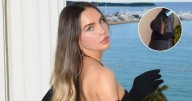 Belinda sufre grave lesión, ¿pone en riesgo su participación en ‘Mentiras El Musical’?
