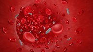 Common condition that affects millions could DOUBLE your risk of developing deadly sepsis