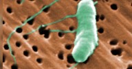 Flesh-eating bacteria kills fifth person this year in Louisiana