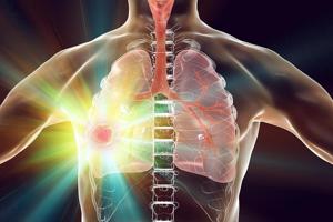 Robot-Guided Device Reaches Tumors Deep In The Lungs