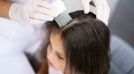 Conflicto en colegios: los piojos no son una amenaza para la salud, pero padres se niegan a que sus hijos queden expuestos