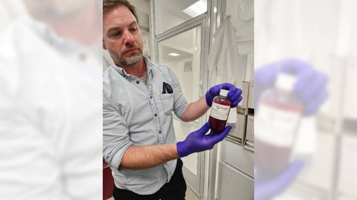 Chagas disease, long considered only a threat abroad, is established in the Southern US