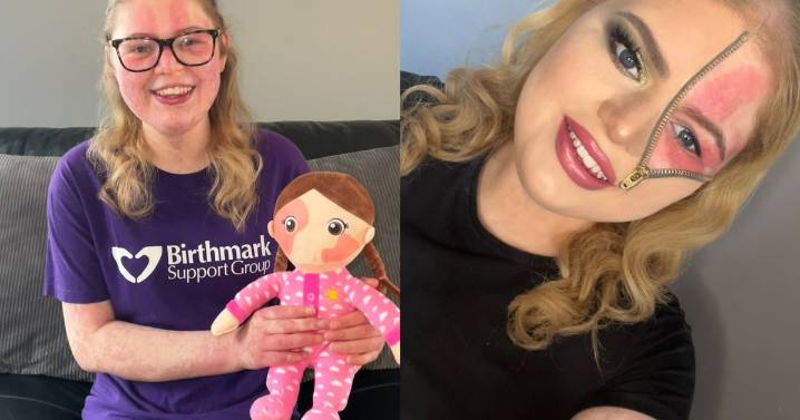 East Midlands woman covered in birthmarks shares inspiring story and says 'no
