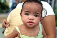 Maxwell: Take a look at the diseases Florida wants to bring back