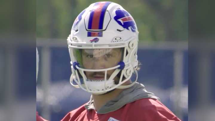 Why is Josh Allen wearing a visor?