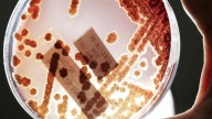 Aumentan en EEUU las infecciones por bacterias resistentes a los antibióticos