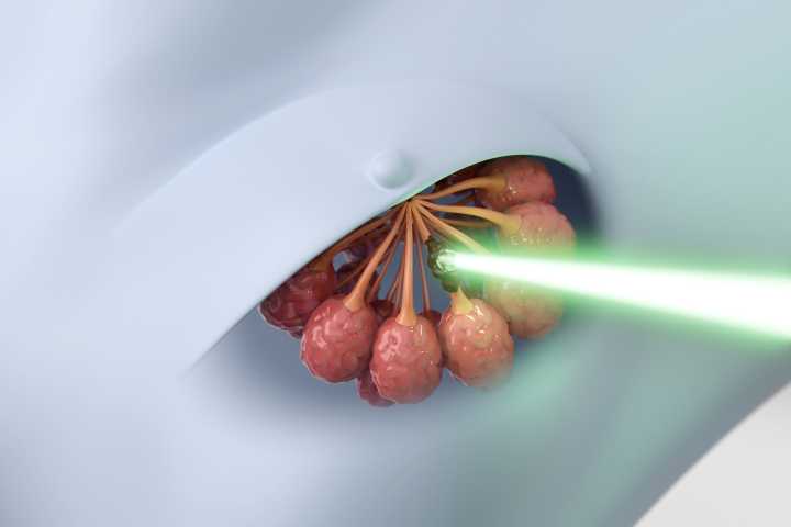 Nanobiotix: Today's Data Readout For Radiation Therapy Enhances Bull Case (NASDAQ:NBTX)