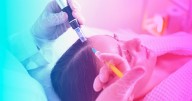 Do Exosome Hair Treatments Work for Hair Loss?