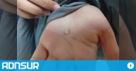 19:03 Denuncian falta de controles de higiene en una escuela de la Patagonia tras encontrar un diente en la comida