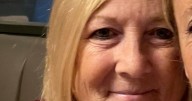 Grandma loses fingers and toes to sepsis after botched diagnosis