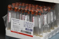 Trump pide a farmacéuticas que publiquen tasas de éxito de vacunas contra COVID-19: “quiero la respuesta, y la quiero YA”