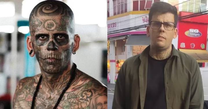 EN FOTOS: El hombre más tatuado de Brasil le dice «adiós» a sus tatuajes y ahora luce irreconocible