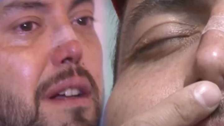 Mauricio Clark y la delicada reconstrucción de nariz a la que se sometió