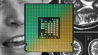 Neuralink, Elon Musk, and the Race to Put Chips Into Our Brains 