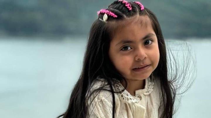 Emilia tiene un tumor facial y los jujeños ayudaron para su tratamiento en Buenos Aires