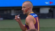 Brisbane premiership hero Kai Lohmann reveals he lost hearing in his left ear minutes into grand final