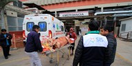 Joven que sufrió accidente vehicular recibirá injerto de piel gracias al financiamiento del SIS