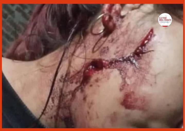 Grave agresión en Presidencia de la Plaza: joven sufrió cortes en el rostro por su expareja