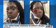 Local woman shares her domestic violence experience to spread awareness, spark change