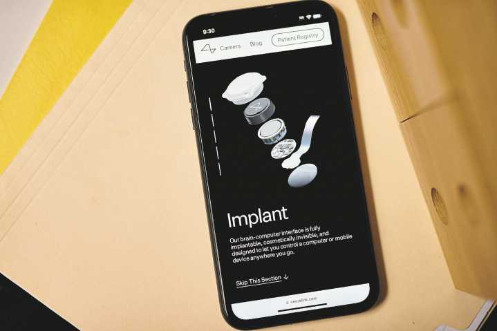 Elon Musk’s Neuralink brain chip clinical trial in Canada raises ethical questions