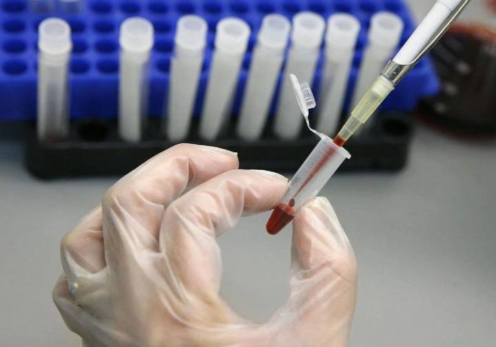 Investigadores vascos desarrollan una herramienta para la detección temprana de enfermedades
